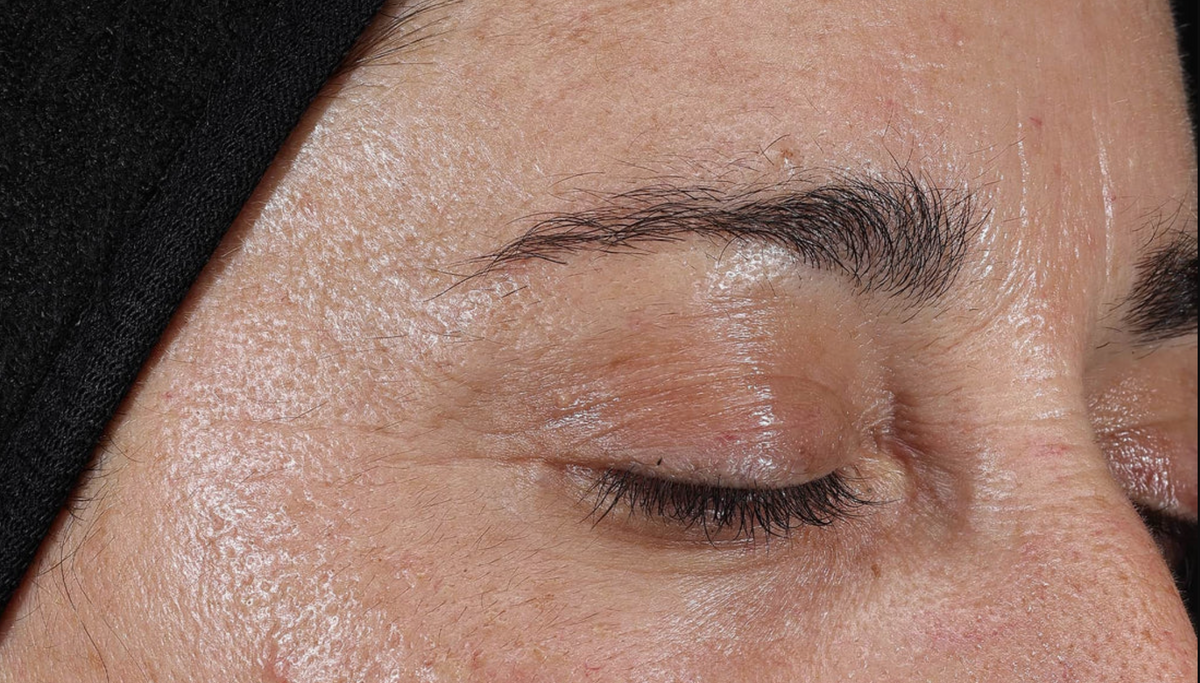 El Retinal con Medik8: La revolución en cuidado facial en España