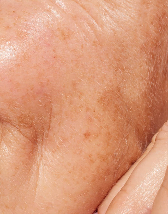 Primer plano de la mejilla de una persona con arrugas y manchas de la edad, destacando la rutina cuidado facial hiperpigmentación.