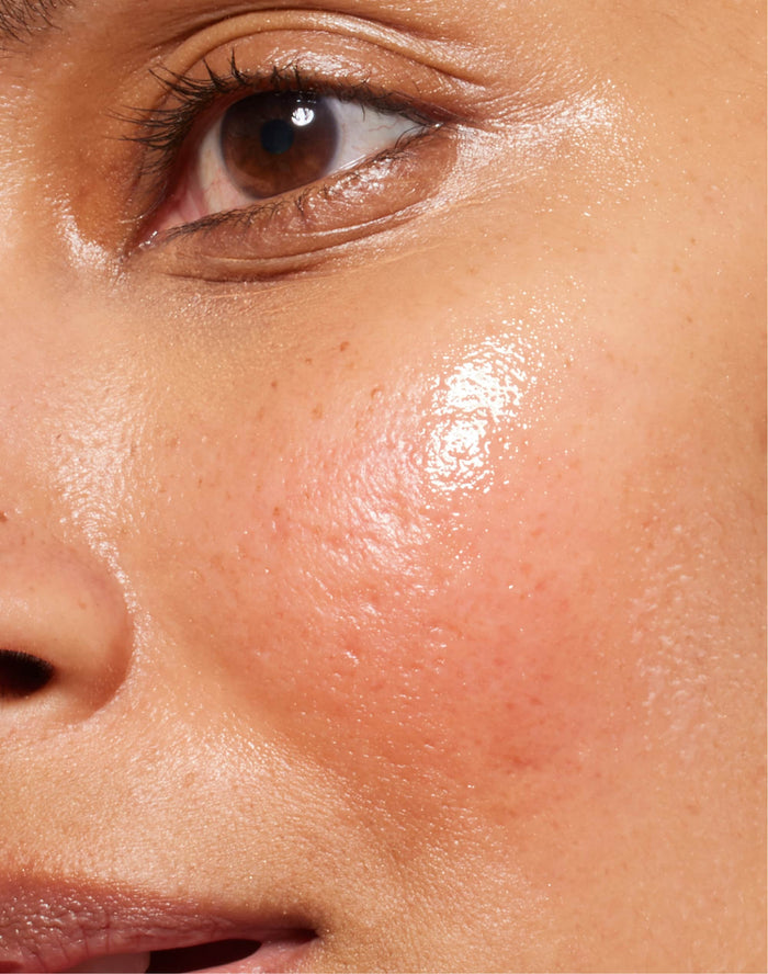 Primer plano de la zona de las mejillas y los ojos de una persona, que muestra una piel hidratada, ideal para un cuidado facial sensible.