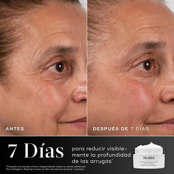 Antes y después de 7 días usando Medik8 Advanced Pro-Collagen+ Peptide Cream, reducción visible de arrugas en la piel-hover-25