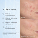 Niacinamide Peptides