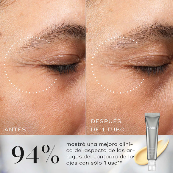 Primer plano comparativo de las arrugas de los ojos antes y después de utilizar Medik8 Crystal Retinal Ceramide Eye, que muestra una reducción visible de las líneas.