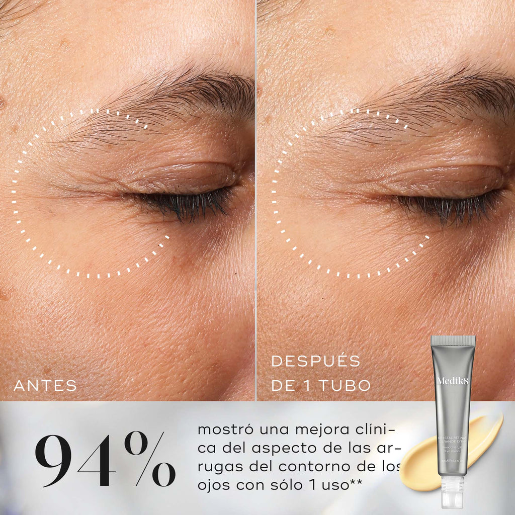 Primer plano comparativo de las arrugas de los ojos antes y después de utilizar Medik8 Crystal Retinal Ceramide Eye, que muestra una reducción visible de las líneas.