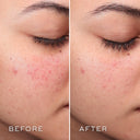 Press & Clear™ Refill la opción sostenible para recargar tu tónico exfoliante